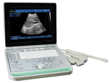 Konveks Lineer Transvaginal Problu 3D Dijital B / W Taşınabilir Ultrason Tarayıcı