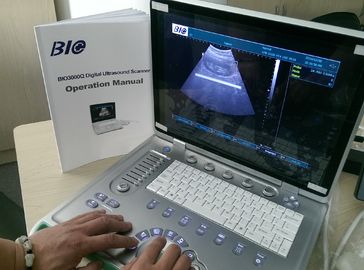 PC Tabanlı B / W Taşınabilir Ultrason Tarayıcı 15 inç Laptop Ekran Sadece 5kgs Ağırlık Taşınabilirlik Uygun