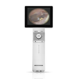 Digital Video Otoscope Full Digital Inspection With SD Card Output USB Otoscope