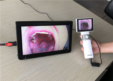 Taşınabilir Otoskop Oftalmoskop Video Boğaz Kamera Kliniği Için SD Kart Çıkışı Ile Dermatoskop