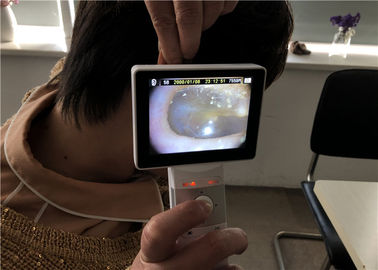 Yüksek Çözünürlüklü El Dijital Video Otoskop Dermatoskop Oftalmoskop