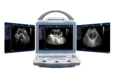 Çift Prob Konnektörlü Hastane Ultrason Makinesi Taşınabilir Ultrason Tarayıcı