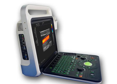 Ultrason Görüntüleme Makinesi 160G Kapasiteli Taşınabilir Ultrason Tarayıcı