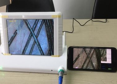Dijital Büyüteç El Video Dermatoskop Cilt Analizörü ile Yağ Nem Pigment Veri Raporu Esnek