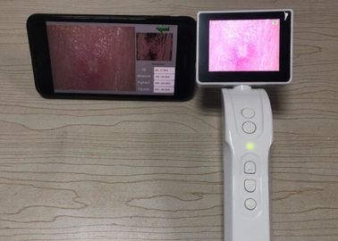 El Dijital Dermatoskop Video Dermatoskop Mobilephone 3.5 inç Ekran Wifi Bağlantısı