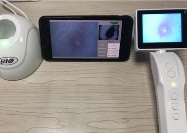 50, 200 Times Lensli Dijital Magnicication Video Dermatoskop Cilt ve Derisi Analiz Cihazı