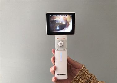 Mikro SD Kart USB Kulak Kamera Dijital Video Otoskop Genel Görüntüleme Ve Dermatoskop