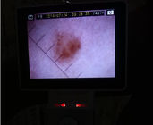 LCD ekran Dijital Video mastar Ophthalmoscope insan vücudunun klinik muayene için