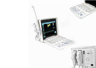 2 Prob Bağlantısı Yüksek Çözünürlüklü CFM PDI PW Modlu Taşınabilir Ultrason Tarayıcı