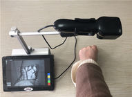 Tıbbi Taşınabilir Ven Bulucu Cihaz Örümcek Damar Temizleme Makinesi Görüntüleme Derinliği &amp;lt;10mm
