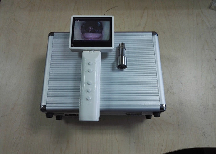 Handheld Mini Kamera Laringoskop Otoskop Oftalmoskopu En Yüksek - Sınıfla