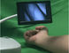 5 Inç Ekranlı Taşınabilir Damar Görüntüleme Cihazı Anemi bulunan hastalar için Kızılötesi Damar Bulucu