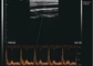 MSK Meme Tiroidi İçin Renkli Doppler Taşınabilir Cep Ultrason Tarayıcı Uygulaması