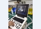 Taşınabilir Ultrason Teşhis Makinesi Dizüstü Prob Renkli Doppler Ekipmanı