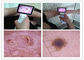 Renkli TFT LCD USB Otoskop ile İnsan Vücudu Dijital Video Otoskop Klinik KBB Muayene