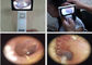 Kulak Deri ve Genel İmajı İçin 1920 x 1080 piksel CMOS Akıllı Tıbbi USB Video Otoskopu
