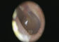Yüksek Çözünürlüklü Nötr Beyaz Işık Dijital Video Otoskop Dermatoskop ve Otoskop Kamera