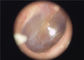 Tek Kullanımlık Kulak Ucu Mevcut Tıbbi Portatif Kulak Burun Boğaz Kulak İçi Boğaz için Endoskop
