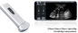 Mutil Language Fetal Color Doppler Ultrasound Scanner With Micro - Convex Probe