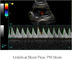 Renkli Doppler Ultrason Sistemi 12.1 inç LED Monitör ve 2 Prob Bağlantı Noktalı Taşınabilir Ultrason Tarayıcı
