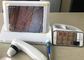 8 inç Ekranlı Dijital Elde Taşınabilir Video Dermatoskop 1.4,9 Resim Görüntüleme