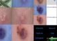 Cilt ve Saç Derisi Dedektörü Video Dermatoskop ile Nemlendirici Yağ Pigmenti Esnek Raporu