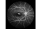 Lazer Taramalı Fundus Kamera Fundus görüntülemeli Profesyonel Oftalmik Ekipman FOV 160 ° Minimum Göz Bebeği Boyutu 2 mm