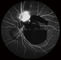 Konfokal Retina Oftalmoskop Dijital Fundus Kamera, FOV 15 °, 30 °, 60 ° Görüntü Boyutu 1024 * 1024
