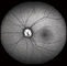Konfokal Retina Oftalmoskop Dijital Fundus Kamera, FOV 15 °, 30 °, 60 ° Görüntü Boyutu 1024 * 1024