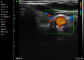 Ipad El Ultrason Tarayıcı Taşınabilir Renkli Doppler Abdominal Vasküler Pediatri Jinekoloji Uygulaması