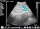 Ev Doppler Ultrason Taşınabilir Teşhis El Doppler Ultrason Obstetrik Jinekoloji Pediatri Uygulaması