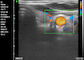 Ev Doppler Ultrason Taşınabilir Teşhis El Doppler Ultrason Obstetrik Jinekoloji Pediatri Uygulaması