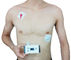 Kardiyak risk Mikro Ayaktan EKG İzleme Sistemi, Kişisel Bakım Kalp Cihazları