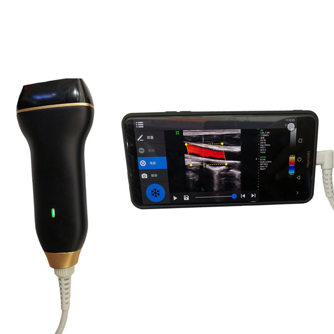 USB Bağlantılı Evde Ultrason Görüntüleme Makinesi Renkli Doppler Ultrason Tarayıcı