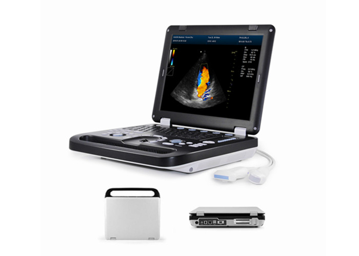 Disbukey Problu Gebelik Testi Icin Yuksek Kaliteli 2d Tam Dijital Renkli Doppler Makinesi