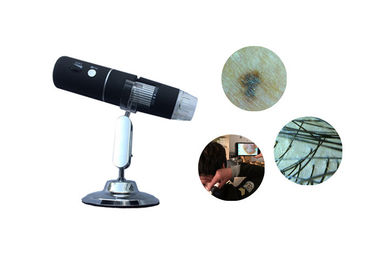 PC Veya Telefon Kullanılabilir Siyah Silikon Dijital Kablosuz Video Dermatoskop Cilt Tarayıcı