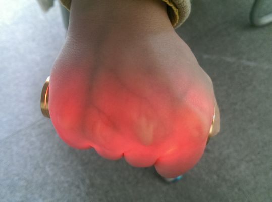 Taşınabilir Vasküler Projektör Venipunktür Kızılötesi Damar Bulucu Damar Bulucu Golden Aluminum