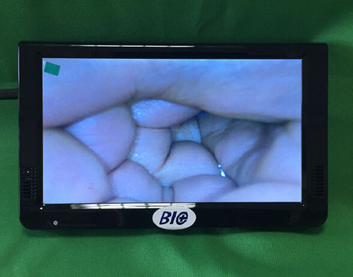 Taşınabilir Dijital Elektronik Kolposkop