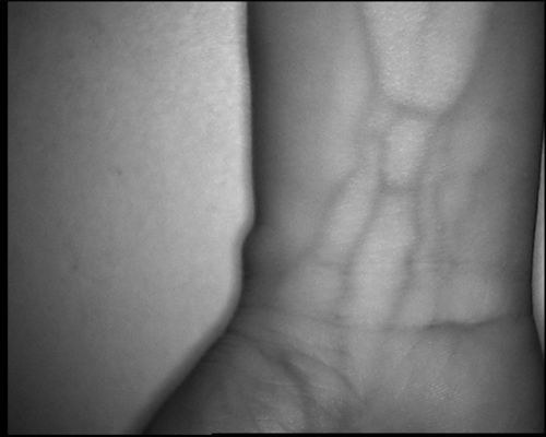 El Alma Bacağı için 3,5 inç Ekranlı Yüksek Çözünürlüklü 800X480 Masa Tipi Damar Bulma Cihazı