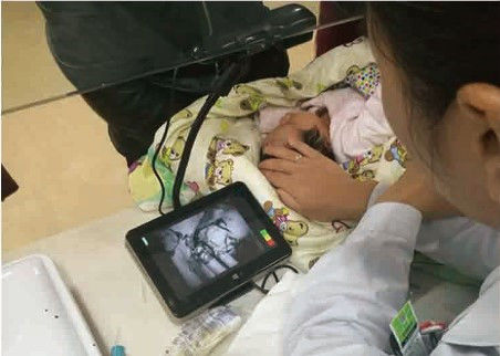 Taşınabilir Ekonomik Kızılötesi Ven Bulucu Ven Arabasının Yaklaşık 10mm Derinliğini Algılama