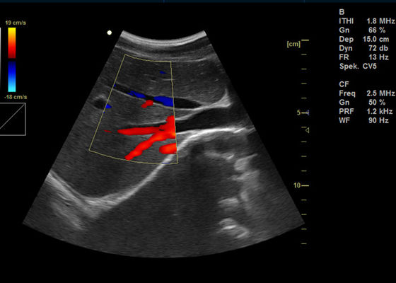 15 inç Tam Dijital Renkli Doppler Makinesi Taşınabilir Doppler Görüntüleme Ultrason 2 USB Portu Ile