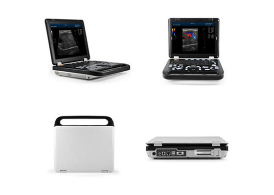 Bir Prob Bağlantısı ve İki USB bağlantı noktası ile 15 inç LED Teşhis İnsan Ultrason Tarayıcı