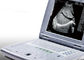 Hamilelik için Taşınabilir Ultrason Makinesi Taşınabilir Ultrason Tarayıcı Sadece 2.2kgs Ağırlık