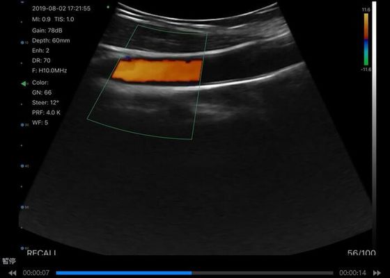 Dijital Kablosuz Elde Taşınabilir Ultrason Tarayıcı