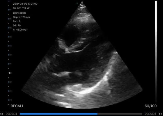 Dijital Kablosuz Elde Taşınabilir Ultrason Tarayıcı