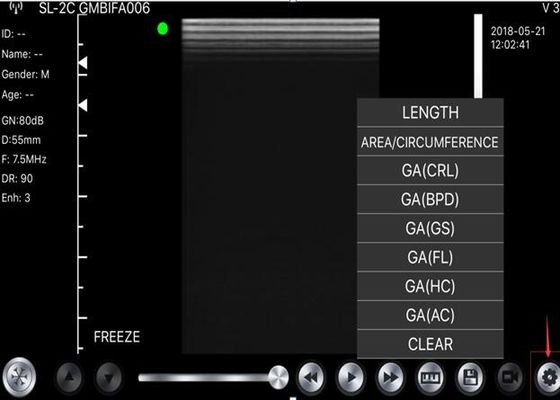 5G Elde Taşınabilir Ultrason Tarayıcı Dışbükey: 3.5 ~ 5MHz, Doğrusal: 7.5 ~ 10MHz, Kardiyak: 2.5 ~ 5MHz
