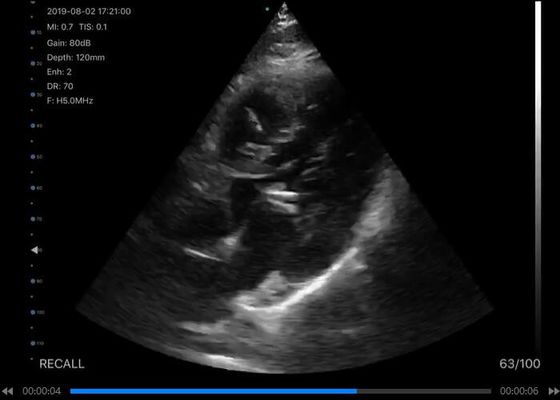 5G Elde Taşınabilir Ultrason Tarayıcı Dışbükey: 3.5 ~ 5MHz, Doğrusal: 7.5 ~ 10MHz, Kardiyak: 2.5 ~ 5MHz