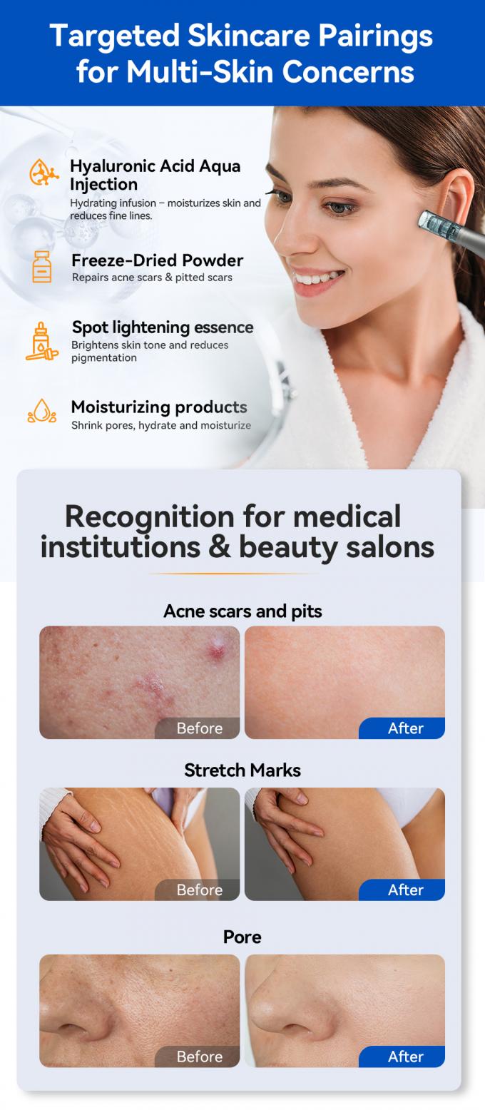 MTS Hydra Pen H5 Mikroiğneleme Derma Kalemi Popüler Yaşlanma Karşıtı Cilt Bakım Cihazı Yüz Cilt Gençleştirme Beyazlatma Kolajen Terapisi 7