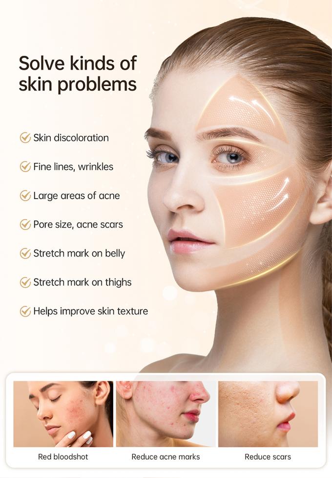 En Yeni 4 Kutuplu EMS Otomatik Serum Uygulayıcı Hydra Pen H5 Y&uuml;z Cilt Derma Mikro İğneleme Kalemi Esans Kolajen Yenilenmesi 3