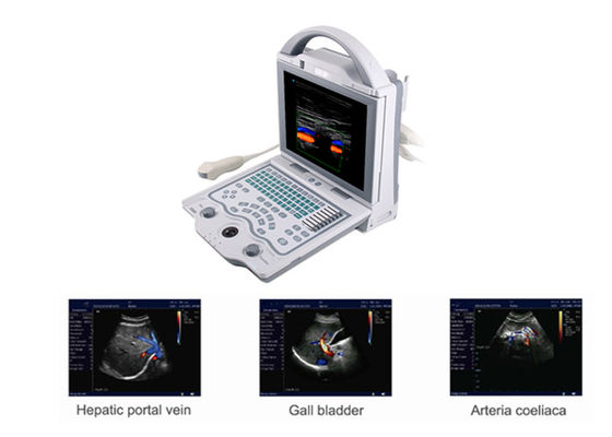 Yalnızca 4.5Kgs Ağırlıklı B Ultrason Tarayıcı Taşınabilir Doppler Ultrason Makinesi